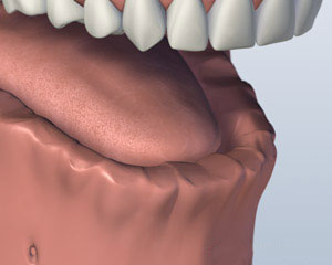 A digital representation of a the lower jaw missing all of its teeth