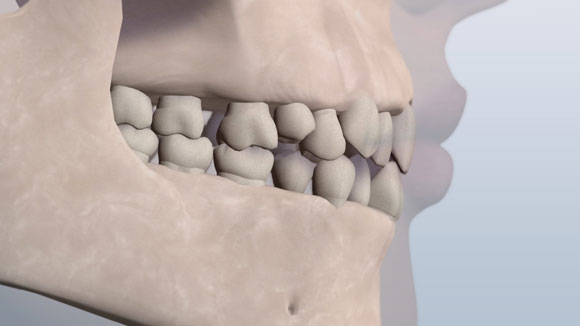 Una imagen de una mandíbula que muestra los dientes en una clase llena de gente. 1 relación