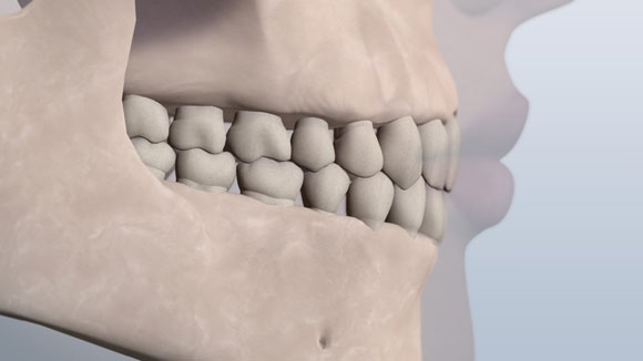 Una ilustración de una mandíbula que muestra los dientes en una clase 1 relación normal