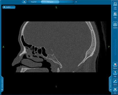 An example image of a CT Scan image.