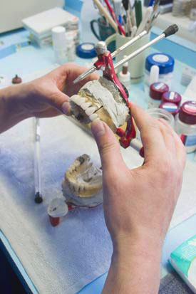 Photo showing a denture specialist repairing dentures