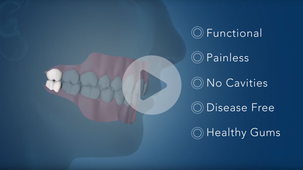 AAOMS video on Dental Implants