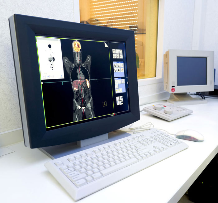 A computer screen showing an image of PET scan results